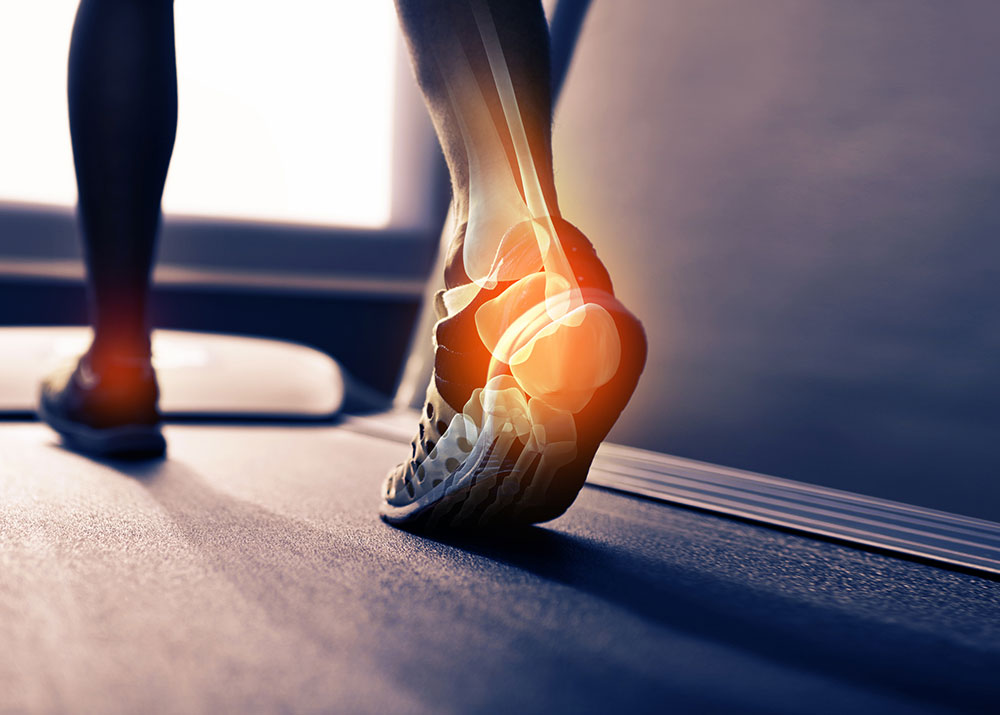 walking on treadmill showing bones of feet